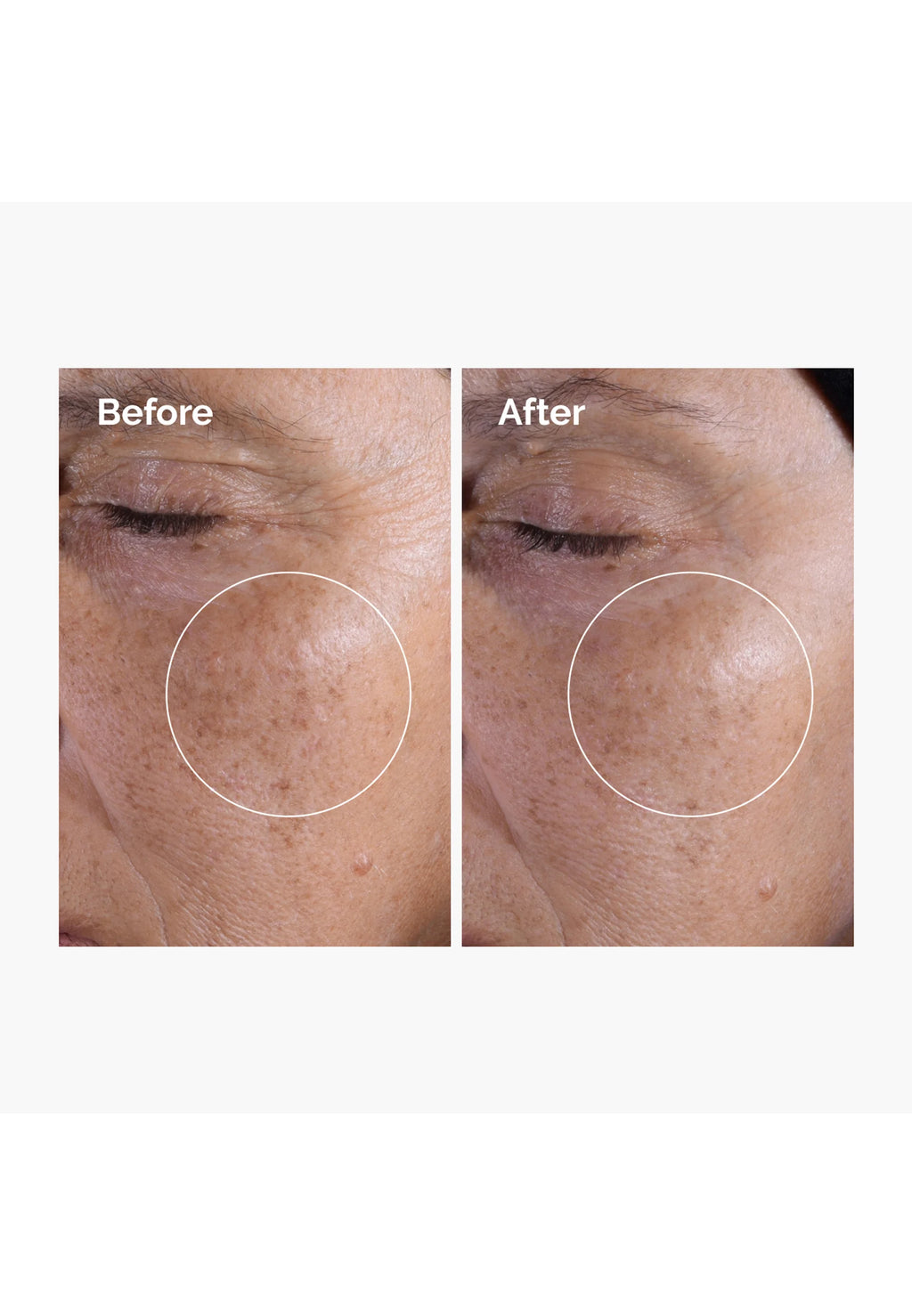 The Ordinary Glycolic Acid 7% Exfoliating Toner - Lotion visage 100ml