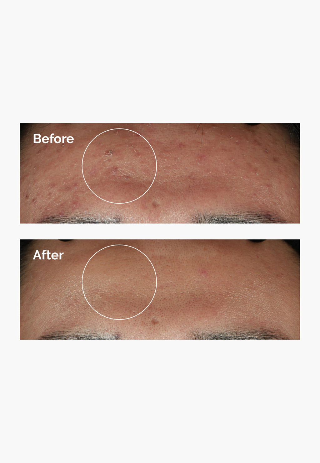 The Ordinary Niacinamide 10% + Zinc 1%